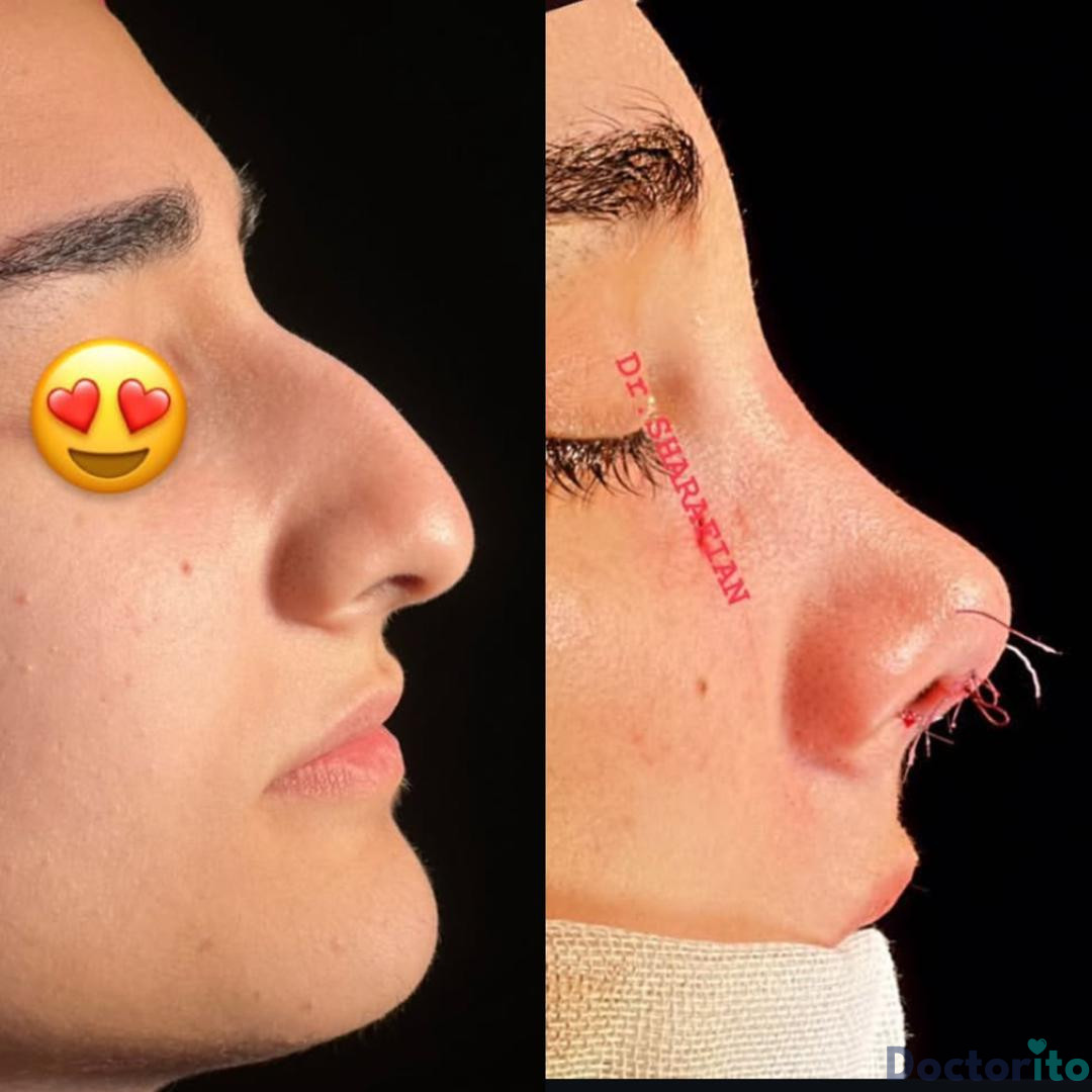 نمونه کار دکتر آرش شرفیان (4)