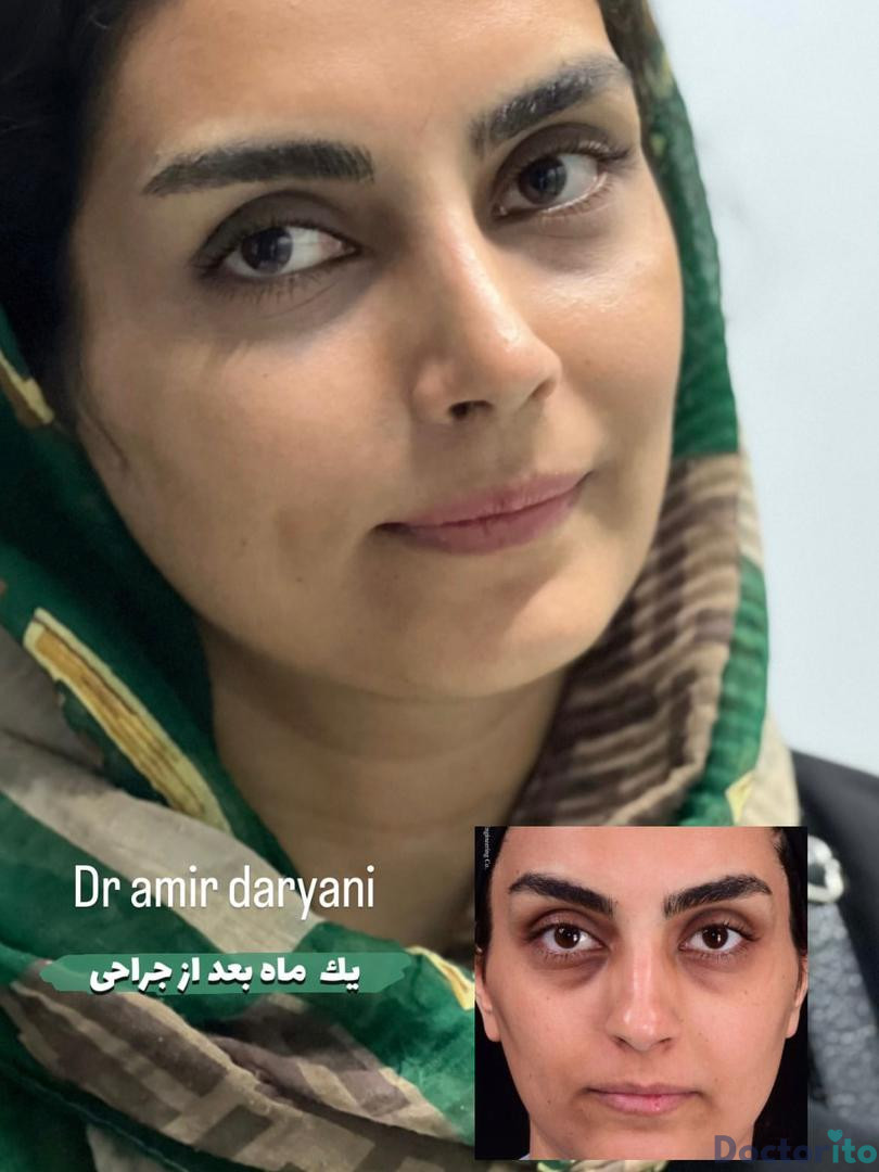 نمونه کار دکتر امیر دریانی (1)