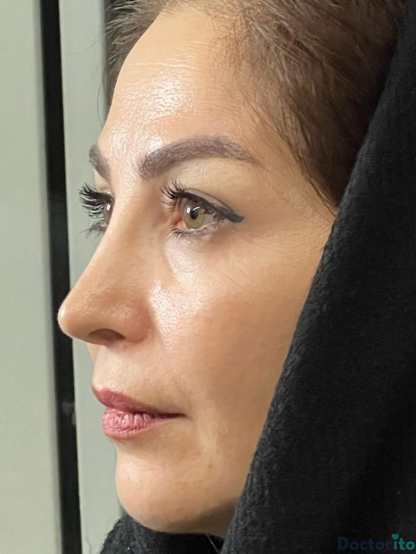 نمونه کار دکتر امیر دریانی (2)