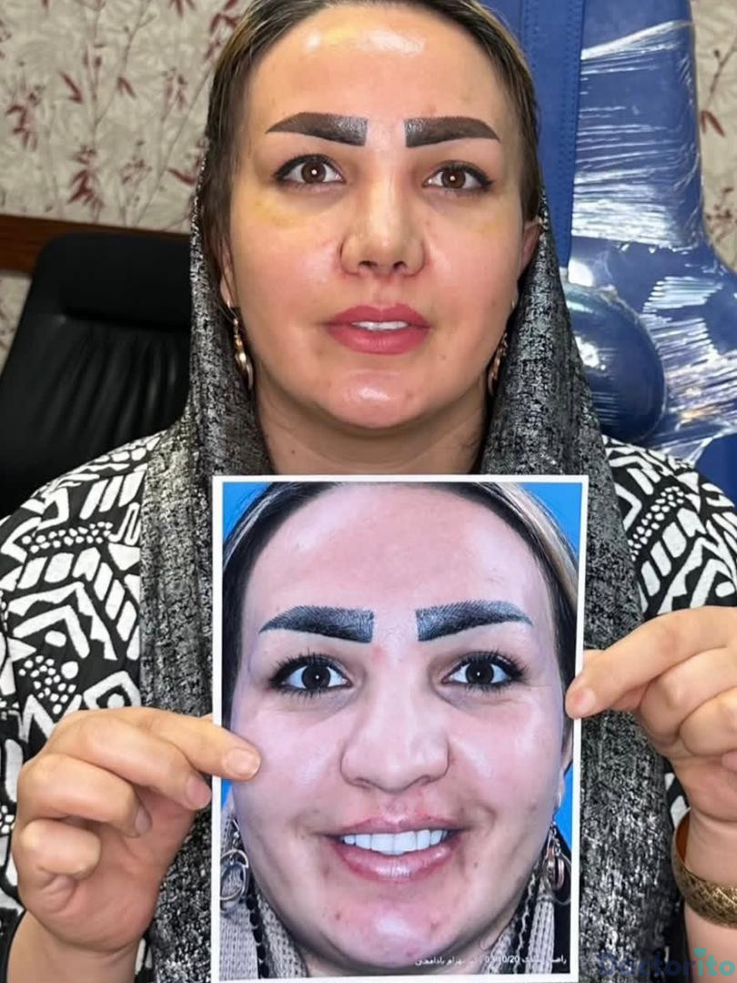 نمونه کار دکتر بهرام بادامچی (1)