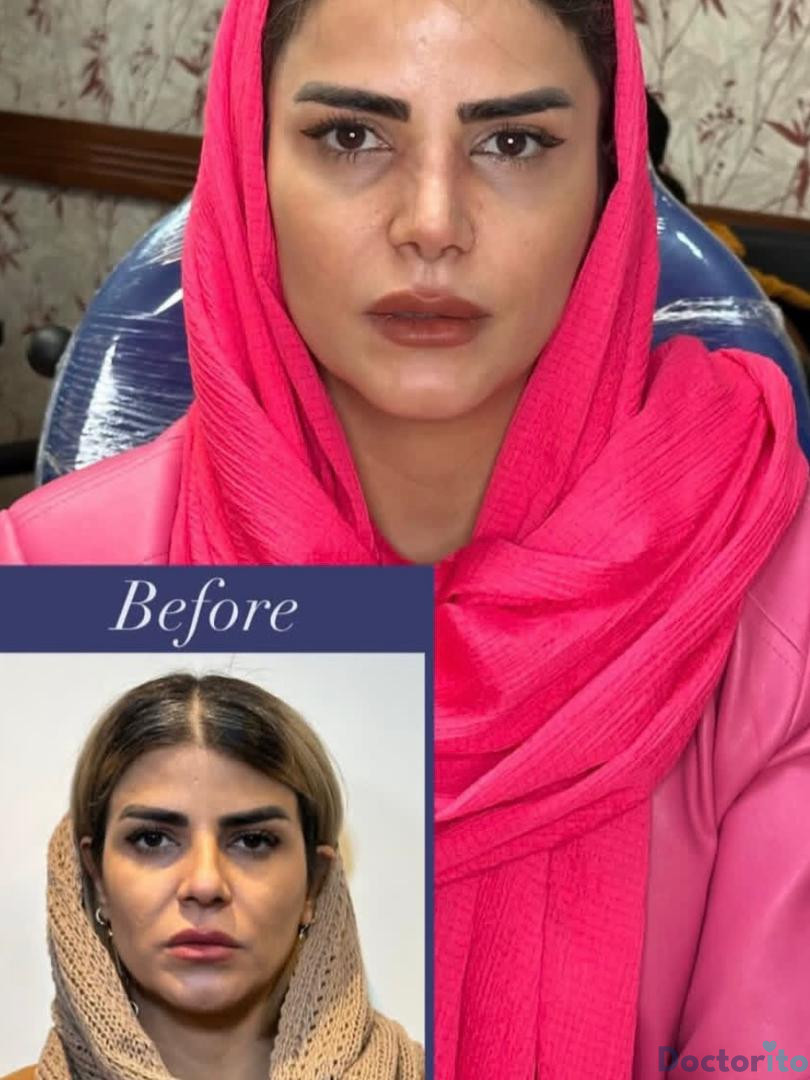 نمونه کار دکتر بهرام بادامچی (2)