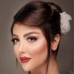 نمونه کار دکتر توکل خانی زاده (1)