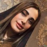 نمونه کار دکتر توکل خانی زاده (4)