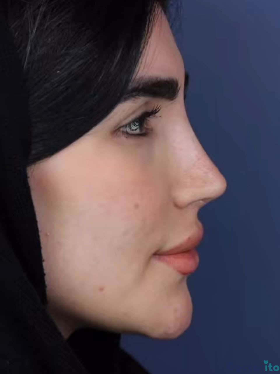نمونه کار دکتر حسام جهاندیده (3)