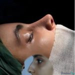 نمونه کار دکتر روزبه راهبر 5
