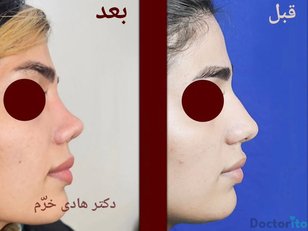 نمونه کار دکتر هادی خرم (1)