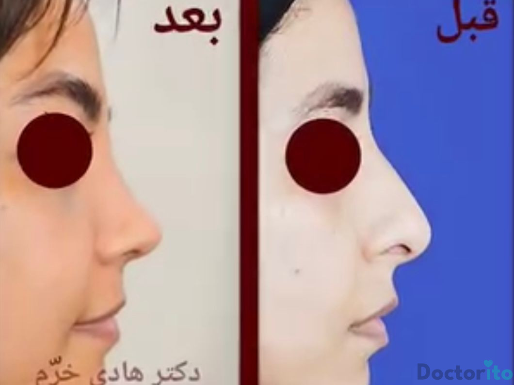 نمونه کار دکتر هادی خرم (3)