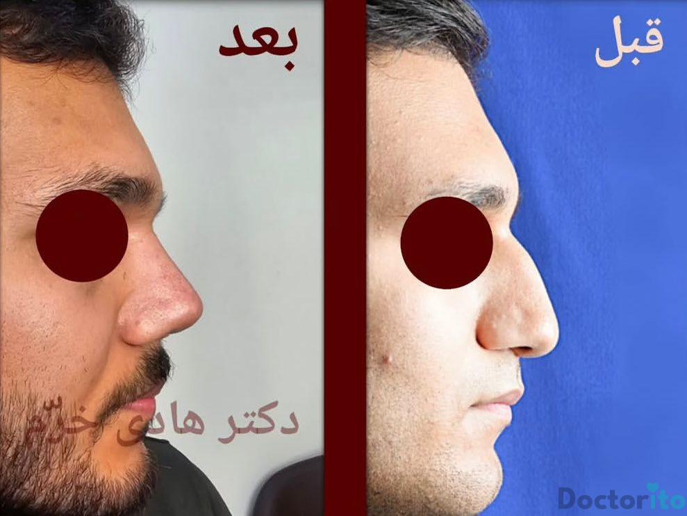 نمونه کار دکتر هادی خرم (4)