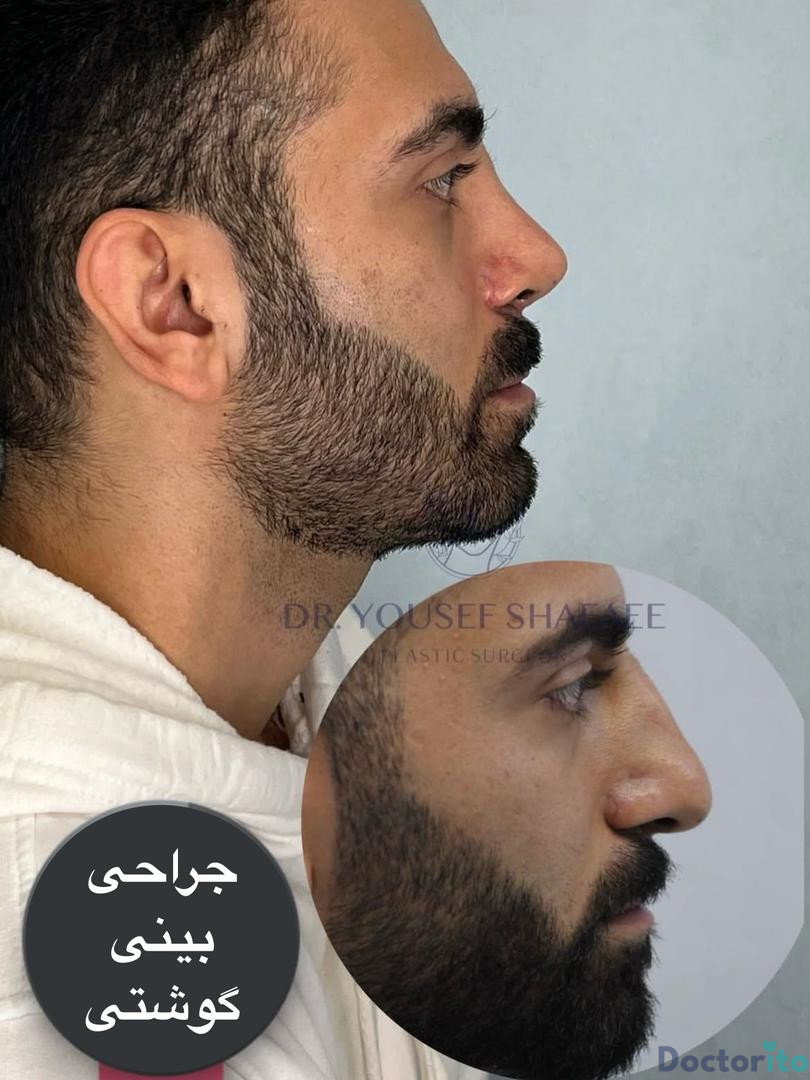 نمونه کار دکتر یوسف شفائی خانقاه (1)