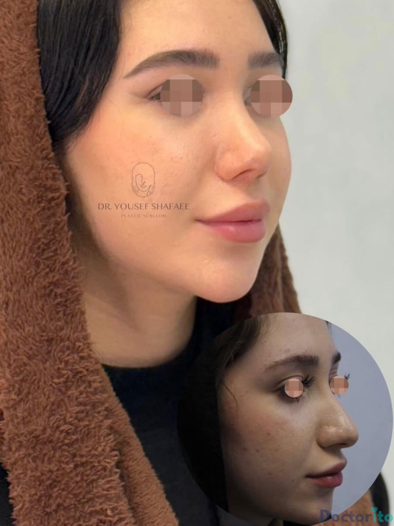 نمونه کار دکتر یوسف شفائی خانقاه (2)