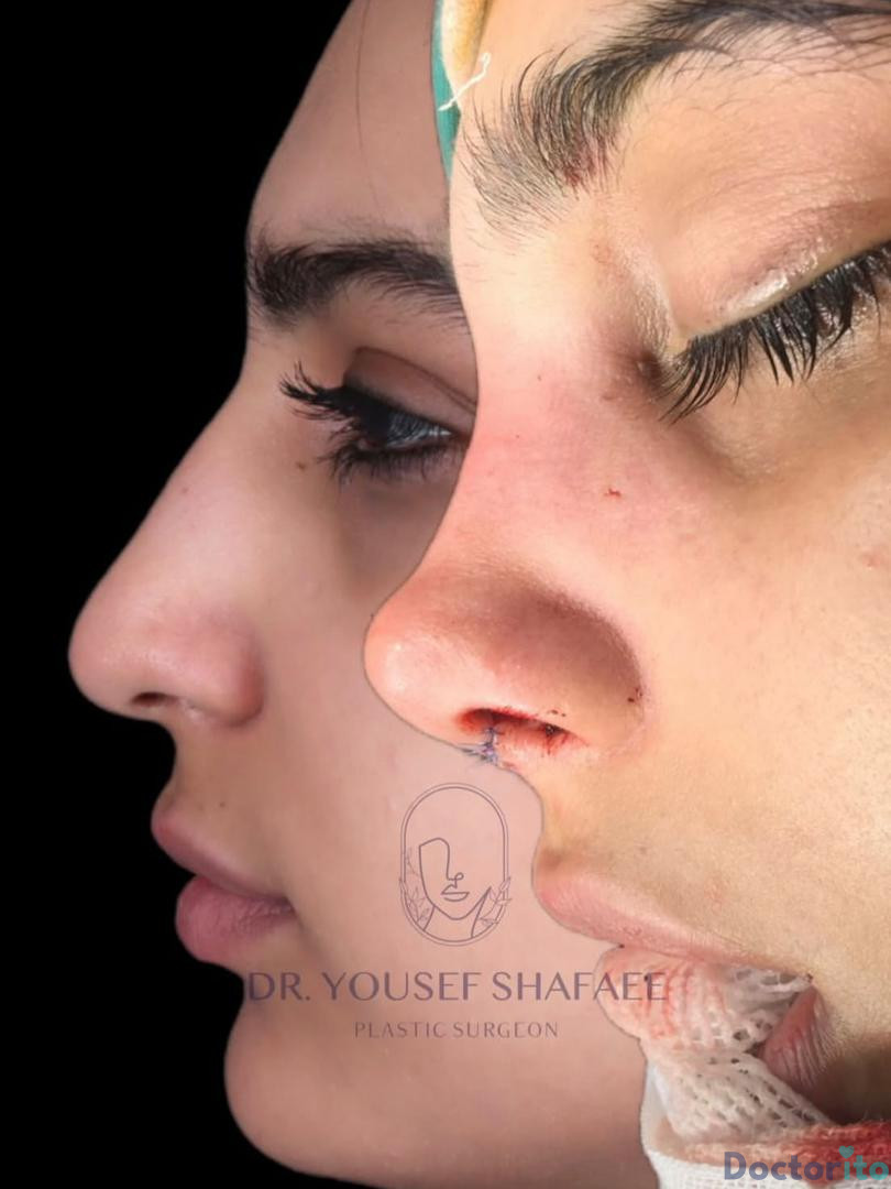 نمونه کار دکتر یوسف شفائی خانقاه (3)