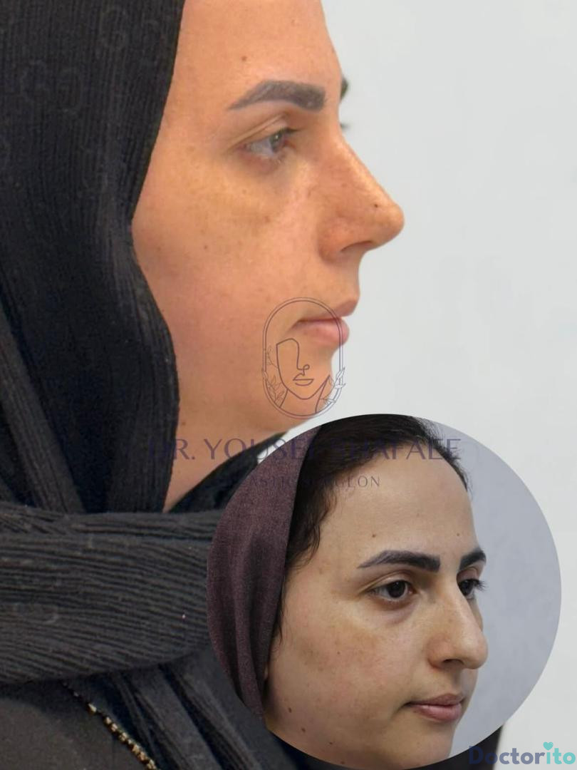 نمونه کار دکتر یوسف شفائی خانقاه (4)