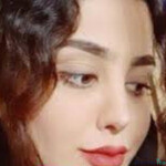 نمونه کارهای عمل زیبایی دکتر مهران جویز (1)