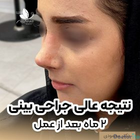 نمونه عمل بینی دکتر نفیسه السادات محمودی