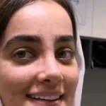 نمونه عمل بینی دکتر علی حسینی واجاری3