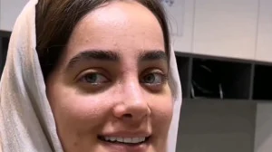 نمونه عمل بینی دکتر علی حسینی واجاری3