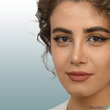 نمونه عمل بینی دکتر سید حسین دستغیب 2