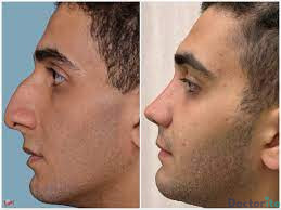 نمونه عمل دکتر بهنام خرمی2