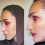 نمونه عمل بینی دکتر ابراهیم فهیم نیا2