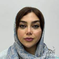 نمونه عمل بینی دکتر امین قانعی