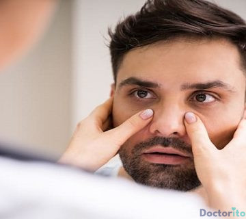 عمل بینی کلیپسی یا منگنه ای