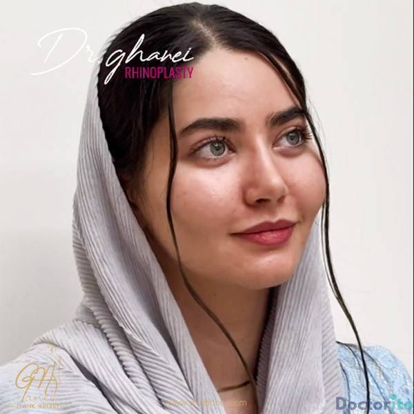 نمونه عمل بینی دکتر امین قانعی (1)