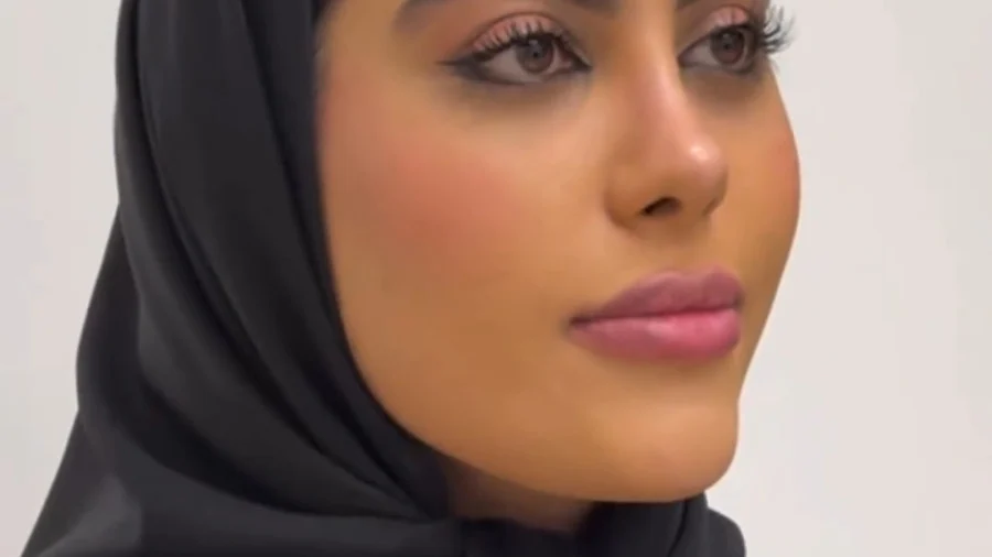 نمونه عمل بینی دکتر امین قانعی 4