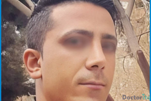نمونه عمل بینی دکتر سید علیرضا خدامی 2