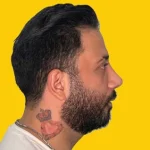 نمونه عمل بینی دکتر سید محمد طالب زاده (1)