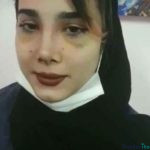 نمونه عمل بینی دکتر شیرین گل محمدی (3)