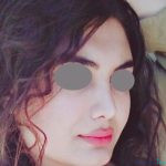 نمونه عمل بینی نیمه فانتزی دکتر ونون آصفی (1)