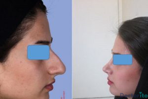 نمونه عمل دکتر دکتر فرشته عبدالمطلبی (1)
