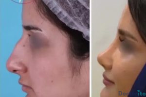 نمونه عمل دکتر دکتر فرشته عبدالمطلبی (2)