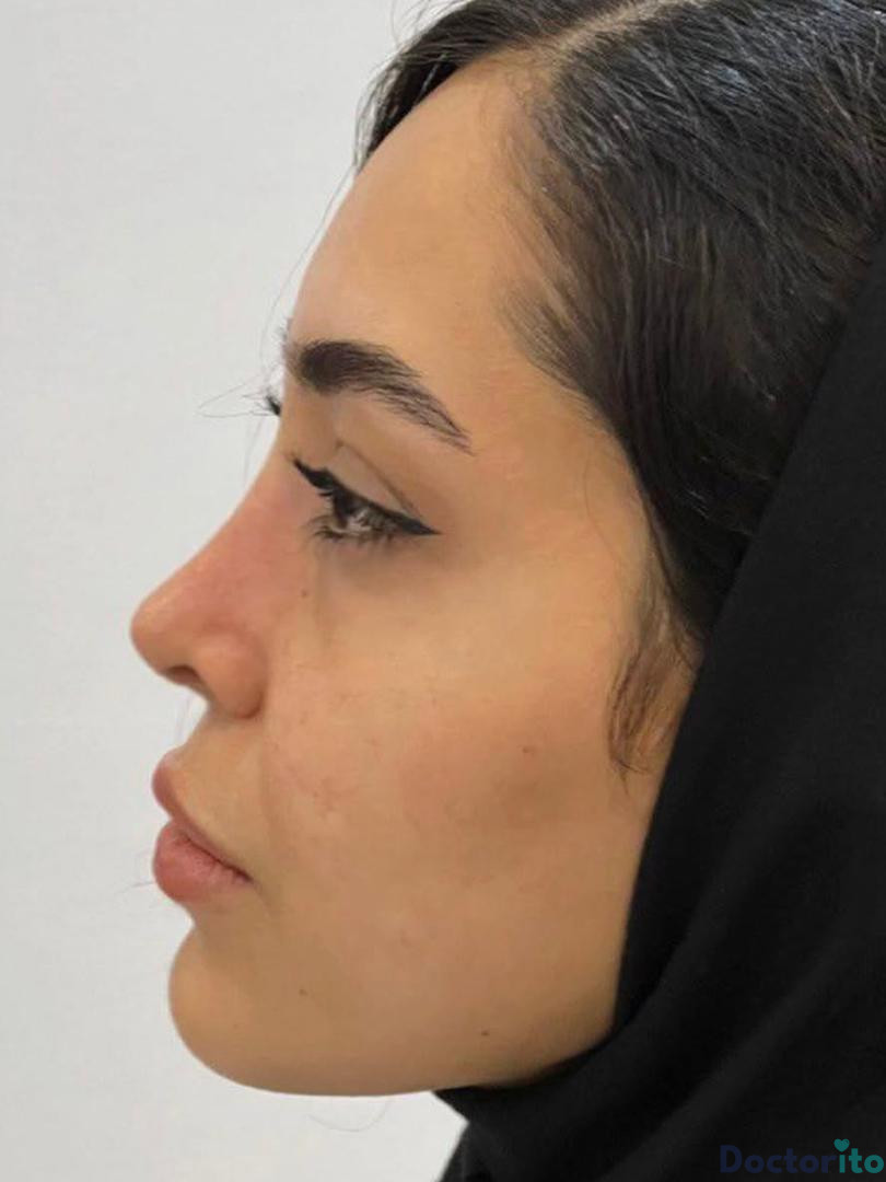 نمونه عمل دکتر شهریار شاهمرادی (1)