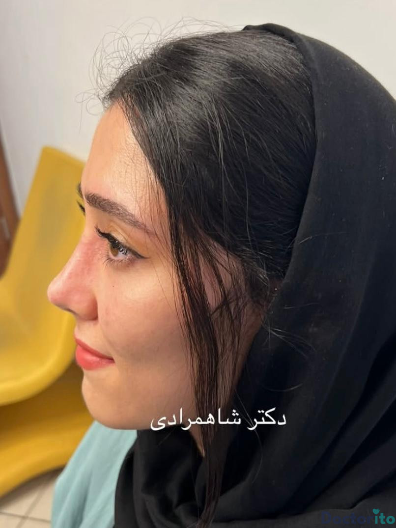 نمونه عمل دکتر شهریار شاهمرادی (5)