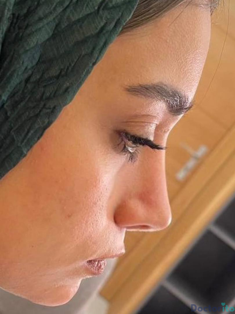 نمونه عمل دکتر شهریار شاهمرادی (6)