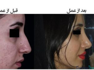 نمونه عمل دکتر عباس نوروزی (1)