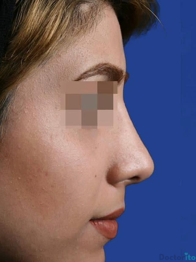 نمونه کار دکتر ابراهیم حاتمی پور (3)