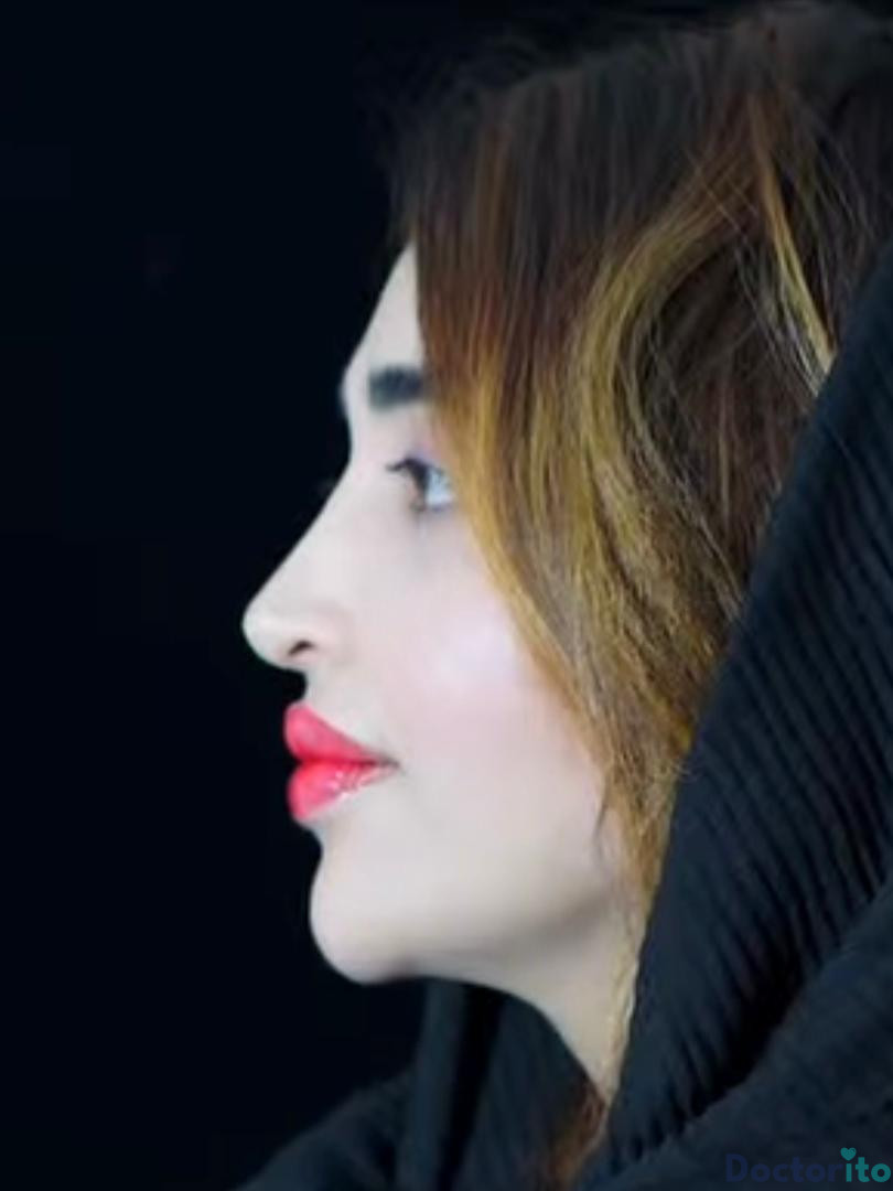 نمونه کار دکتر ابراهیم حاتمی پور (4)