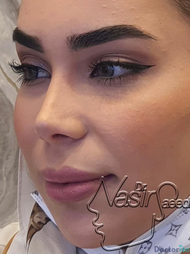 نمونه کار دکتر نصیر سعیدی (2)