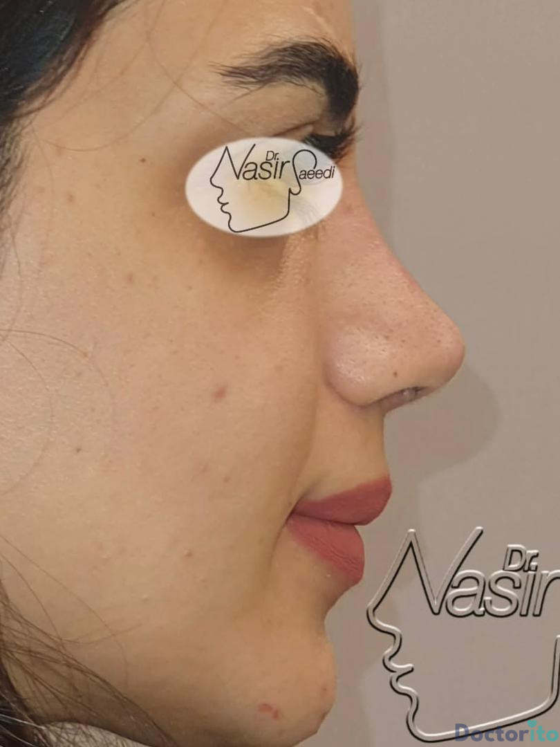 نمونه کار دکتر نصیر سعیدی (5)