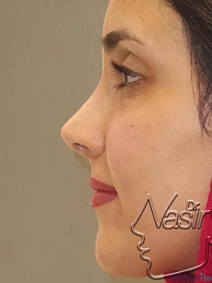 نمونه کار دکتر نصیر سعیدی (6)