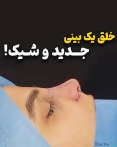 نمونه عمل بینی دکتر مجتبی سهراب پور (1)