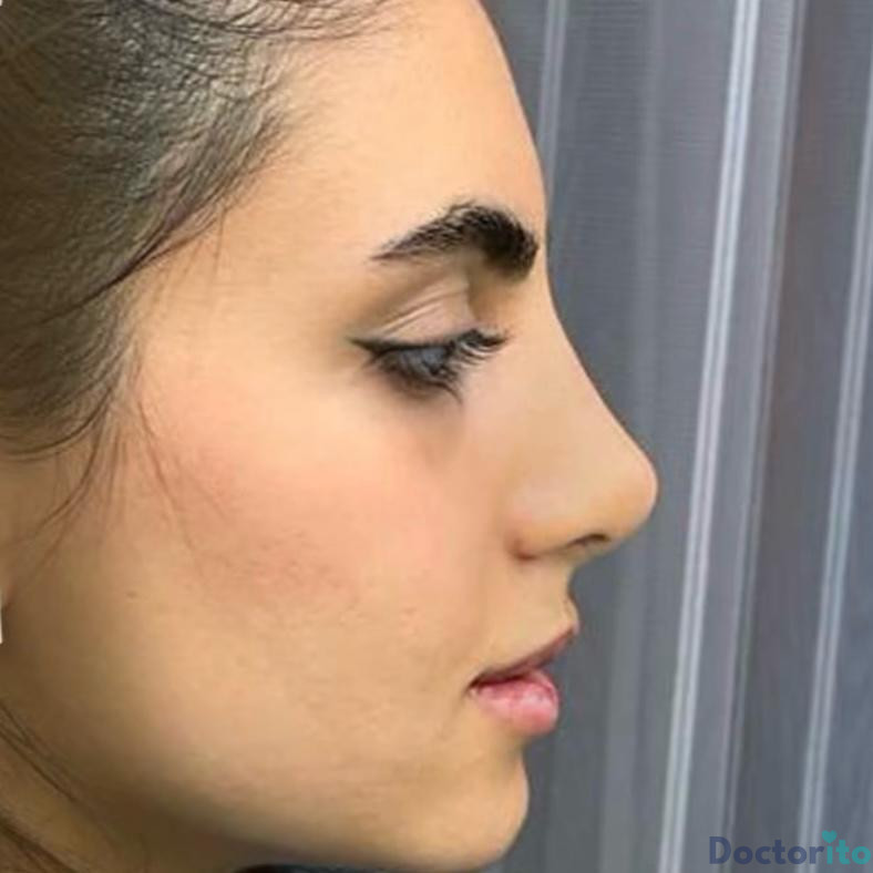 نمونه عمل دکتر دنیا کرمی (4)