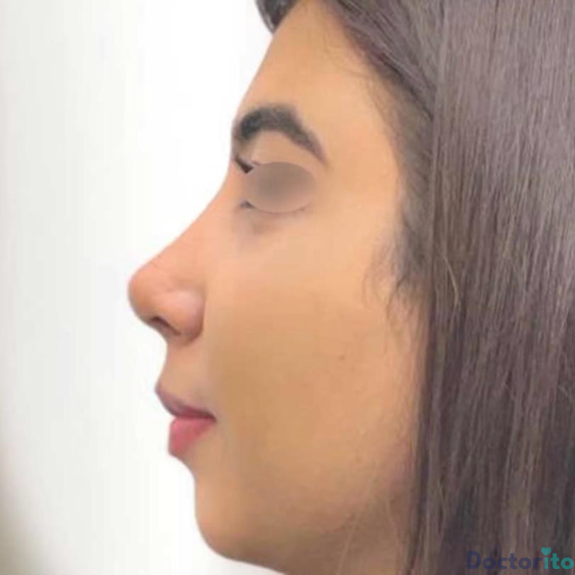 نمونه عمل دکتر دنیا کرمی (5)